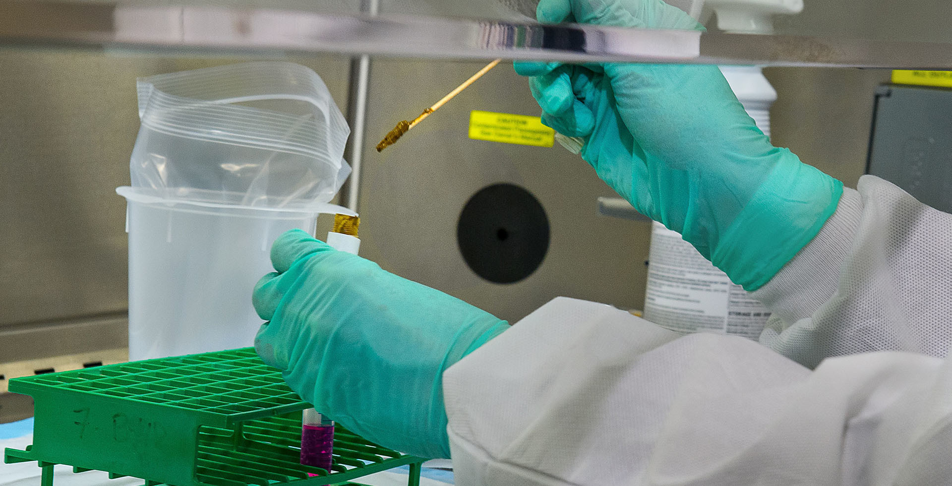 Cómo las aguas residuales pueden preparar a los hospitales frente a un rebrote de la pandemia